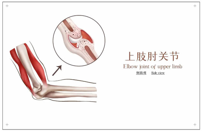 切口仅0.5厘米！这一微创手术巧治10年肘关节顽疾