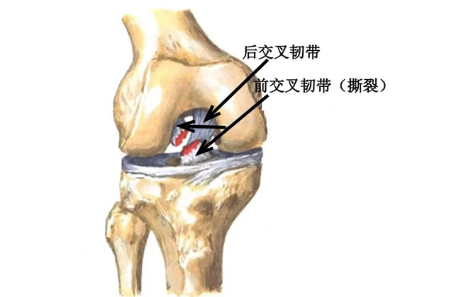 膝盖痛、关节响、腿打软？试试这样做，让膝盖多用几十年！