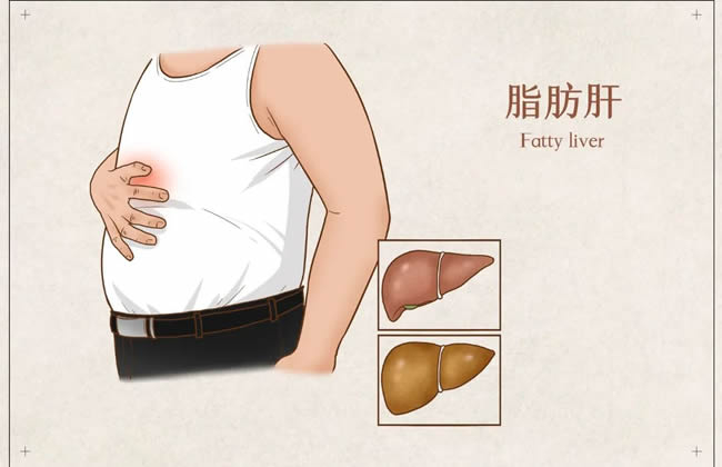 患病率激增！逆转脂肪肝，中医有良方→