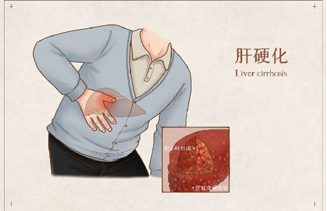 肝硬化中医这样治疗，你绝对想不到！