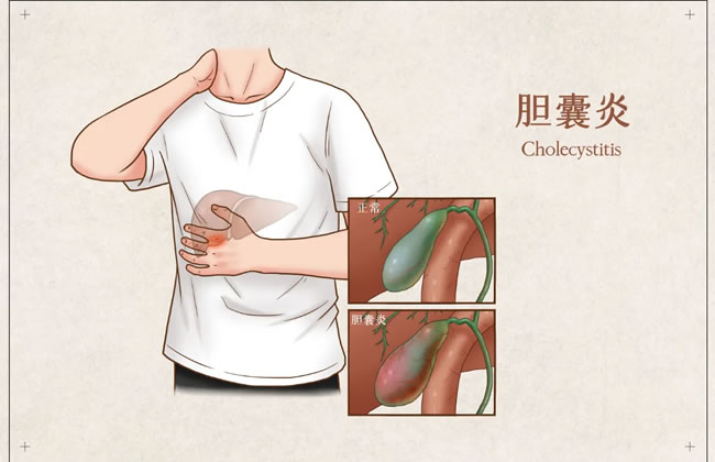 春节要到了，这个科室患者激增......竟是它找上门