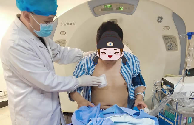 以“针”代刀，肺结节治疗新选择——江医成功完成首例肺结节微波消融术
