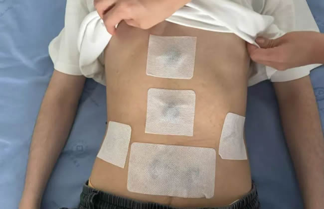 夏季“胃肠贴”开贴啦，大人小孩都管用，调理脾胃正当时！